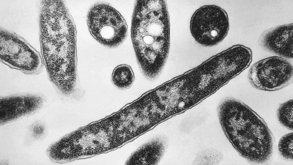 4th Legionnaires' disease death reported in North Carolina